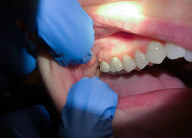 Best Pediatric Emergency Dentist in Avimor, ID